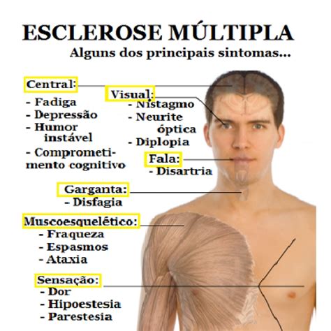 esclerose multipla sintomas iniciais.